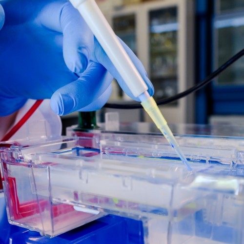  O Avan&ccedil;o da Eletroforese no Diagn&oacute;stico Molecular