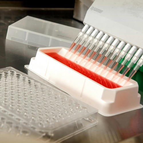 A Evolu&ccedil;&atilde;o dos Testes Sorol&oacute;gicos no Diagn&oacute;stico de Doen&ccedil;as