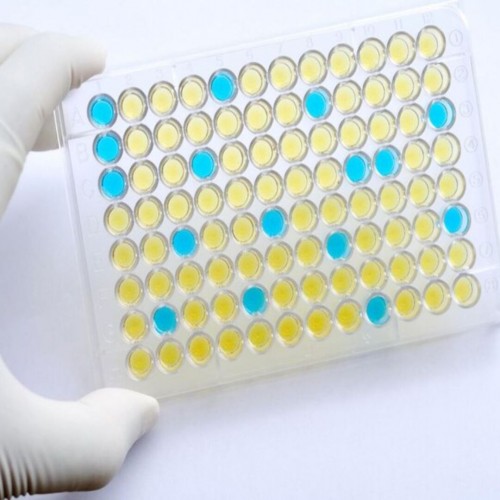 Teste de Elisa: uma ferramenta crucial no diagn&oacute;stico de doen&ccedil;as infecciosas